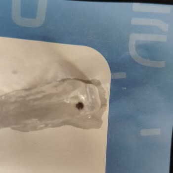 Arby's Den Çıkan Yabancı Cisim