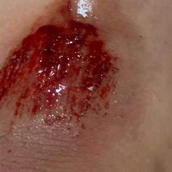 Meram Belediyesi'nin Sokak Köpeklerini Toplamaması