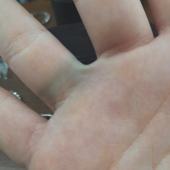 Koton Aldığım Yüzükler İlk Günden Elimi Yemyeşil Boyadı Ve Yüzükler Karardı