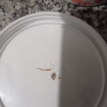 Bebelac Mamadan Yabancı Cisim Çıktı