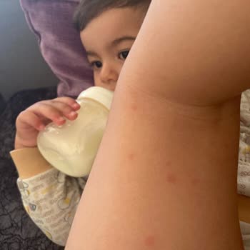 Abdi İbrahim Grintuss Şurubu, Öksürük Krizi Ve Döküntü Yaptı