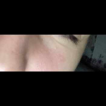 The Purest Solutions The Purest Marka Aha Bha Serum Bozuk