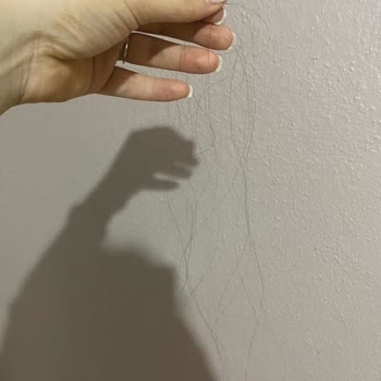 Saç Kaynak Merkezi (İzmit) Bütün Saçlar Elimde Kaldı