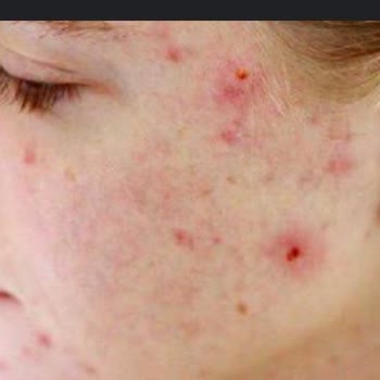 Siera Güzellik Merkezi (Kars) Zorla Para İstemeleri