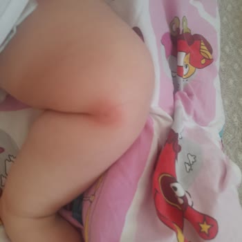 Detan Likit Sinek Kovucu