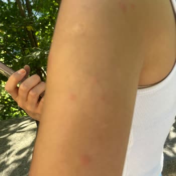 Bahri Hotels Hijyen Sorunu