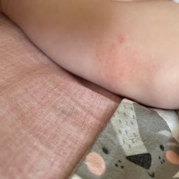 Baby2go Ana Kucağı Takma Aparatı Kırılması