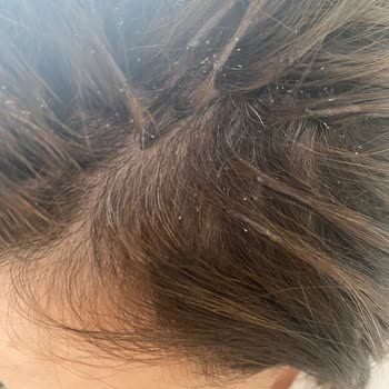 Ali Tuncel Medikal Kaynak Kötü İşçilik, Kötü Kaynak