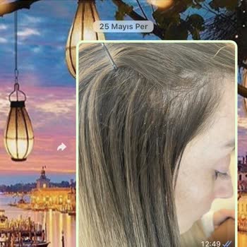 Ali Tuncel Medikal Kaynak Kötü İşçilik, Kötü Kaynak