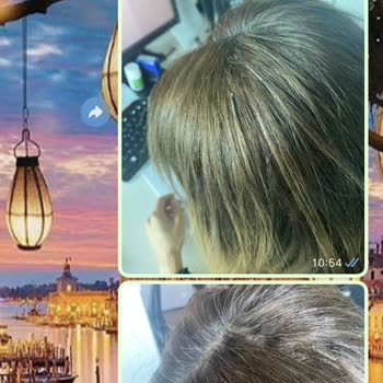 Ali Tuncel Medikal Kaynak Kötü İşçilik, Kötü Kaynak