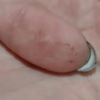 Beypazarı Maden Suyu Paslı Kapak Yüzünden Pas İçmem