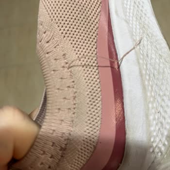 Skechers Yırtılan Ayakkabı. İncelemede Ret Geldi