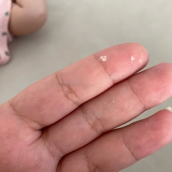 Prima Bebek Bezi Baloncuklar Bebeğime Yapışmış