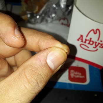 Arby's Kemik Çıktı Hamburgerden