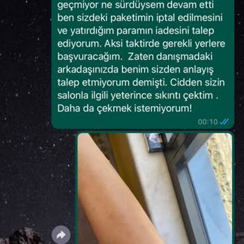 Anatolia Güzellik Merkezi Lazer Yanığı Ve Hizmet
