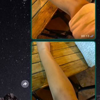 Anatolia Güzellik Merkezi Lazer Yanığı Ve Hizmet