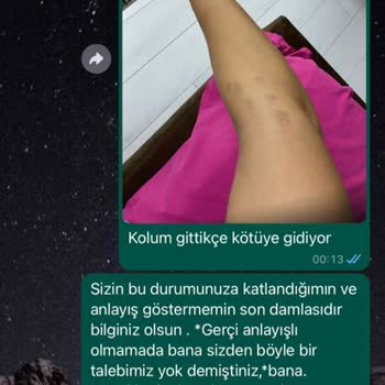 Anatolia Güzellik Merkezi Lazer Yanığı Ve Hizmet