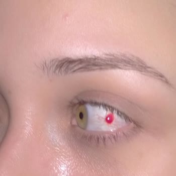 The Purest Solutions Göz Serumu Gözümü Kanattı!