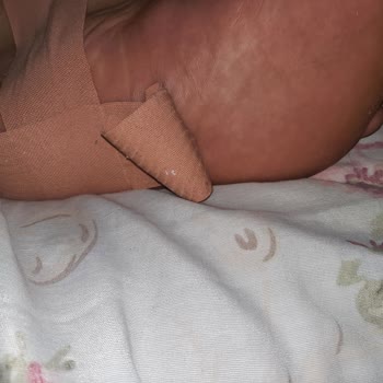 Ens Medikal Bant Şikayeti