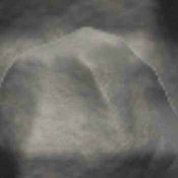 Faceapp Uygulaması Video Problemi