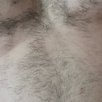 Ankamed Epilasyon ve Güzellik Hizmetleri Lazer Epilasyon Kalitesiz