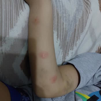 Acıbadem Hastanesi Diş Ameliyat Öncesi