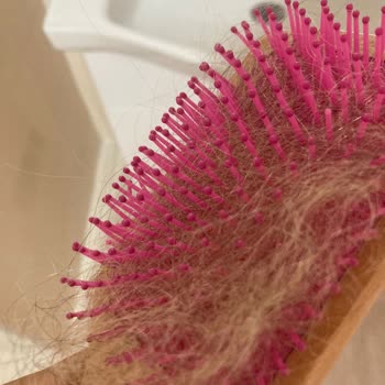 Bekir Alphan Coiffeur Resimler Yanıltıyor, Saçlarım Yandı