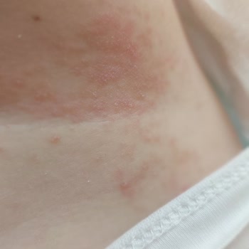 Molfix 3D Bez Değdiği Her Yerde Yara Bırakıyor