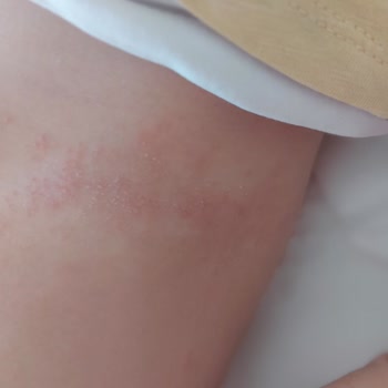 Molfix 3D Bez Değdiği Her Yerde Yara Bırakıyor