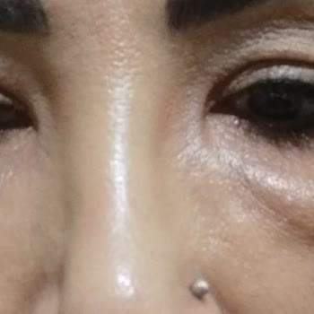 Sibel Kalkan Official Kalıcı Makyaj Yüzümde Travma Yarattı