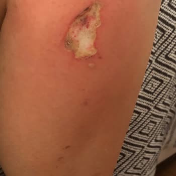 Opera Yaşam Hastanesi Sorumsuzluk Ve Dikkatsizlik