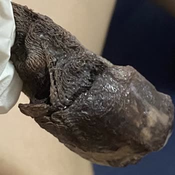 Liv Hospital Kasten Adam Yaralama