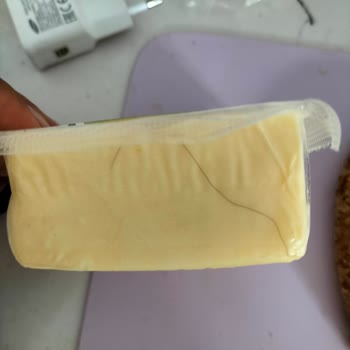 Migros Kaşar Peynirinden Saç Çıkması