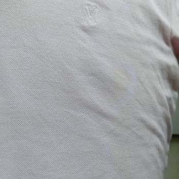 Mavi Markasına Ait T-shirt Aldım Fakat Lekeli Çıktı