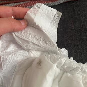 Sleepy Bebek Bezinde Tespit Edilen Küf Kir Bilinmeyen Bir Şey