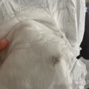 Sleepy Bebek Bezinde Tespit Edilen Küf Kir Bilinmeyen Bir Şey