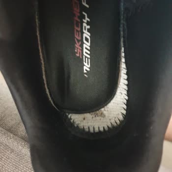 Skechers Ayakkabının Rahatsız Hale Gelen Tabanı