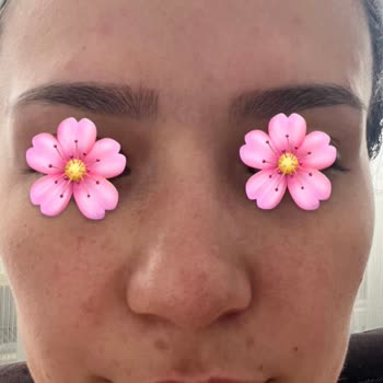 Rise And Shine Pirinç Özlü Sabun Yan Etkisi