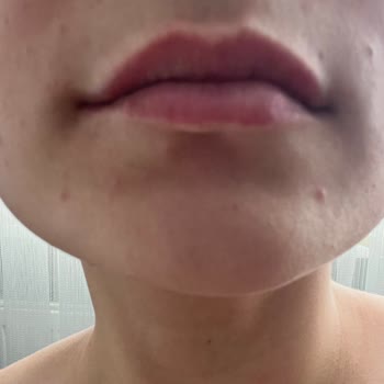 Rise And Shine Pirinç Özlü Sabun Yan Etkisi