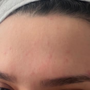 Rise And Shine Pirinç Özlü Sabun Yan Etkisi