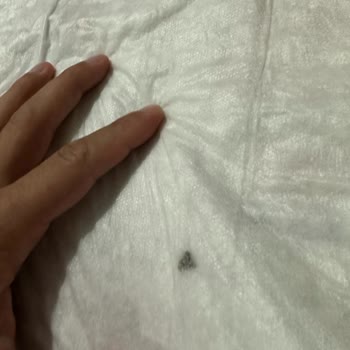 ebebek Alt Açma Örtüsünde Ölmüş Sinek