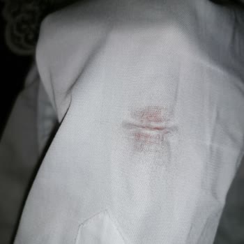 Kiğılı Giyim Gömleklerdeki Yıpranma Sorunu