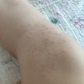 Gratis'ten Aldığım Benri Kids Güneş Kremi Yüzünden Mağdur Olduk