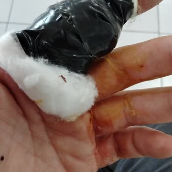 Akhisar Tüvtürk Personel İlgisizlik Ve Emrivakilik