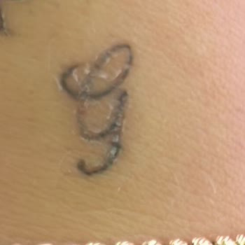 Cleopatra İnk İsimli İşletmeden Aldığım Dövme Sonrası Sorunlar Yaşıyorum