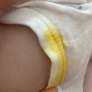 Prima Bebek Bezi Sızdırması