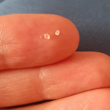 Eti Gıda Üründen Plastik Çıktı