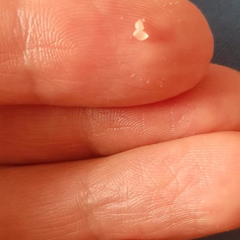 Eti Gıda Üründen Plastik Çıktı