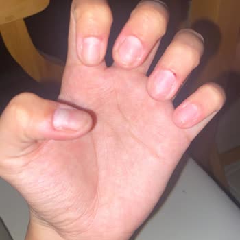 Estetica Plus Protez Tırnak Deneyimim