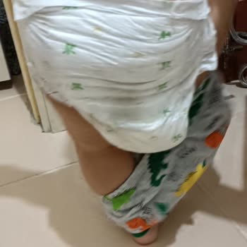 Baby Turco Ürün Kalitesizliği